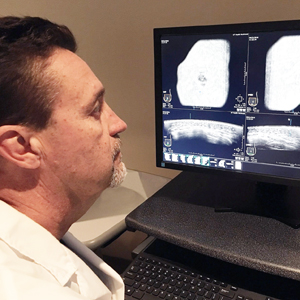 A man in a white coat looks at a computer monitor with images from a breast screening exam